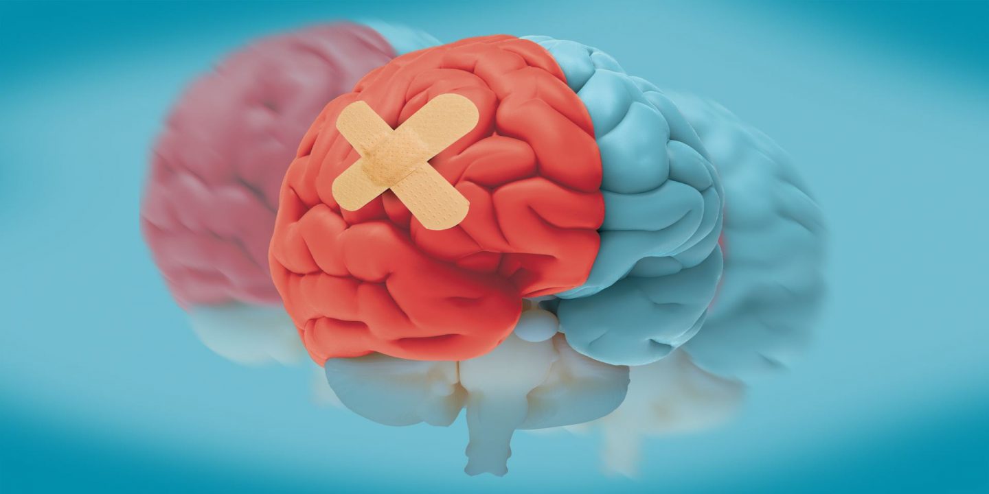 Redbird Scholar cover image showing a model brain that is half red and half blue and with a Band-Aid on the red side